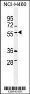 T-SNARE Domain Containing 1 antibody, 55-775, ProSci, Western Blot image 