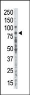 Protein Kinase C Alpha antibody, AP13542PU-N, Origene, Western Blot image 