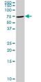 T Cell Lymphoma Invasion And Metastasis 2 antibody, H00026230-D01P, Novus Biologicals, Western Blot image 