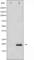 Stathmin 1 antibody, abx011942, Abbexa, Western Blot image 