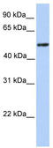 Zinc Finger And BTB Domain Containing 9 antibody, TA345563, Origene, Western Blot image 