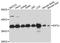 Eukaryotic Translation Initiation Factor 3 Subunit J antibody, A06040-1, Boster Biological Technology, Western Blot image 