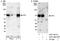 RHE antibody, A301-461A, Bethyl Labs, Western Blot image 