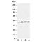 Insulin Like Growth Factor Binding Protein 3 antibody, R30571, NSJ Bioreagents, Western Blot image 