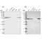 Drebrin Like antibody, NBP1-91989, Novus Biologicals, Western Blot image 