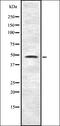 Inositol Hexakisphosphate Kinase 2 antibody, orb337465, Biorbyt, Western Blot image 