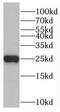 RAB41, Member RAS Oncogene Family antibody, FNab07035, FineTest, Western Blot image 