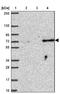 Polycomb protein SUZ12 antibody, NBP2-33834, Novus Biologicals, Western Blot image 