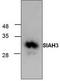 Siah E3 Ubiquitin Protein Ligase Family Member 3 antibody, TA318883, Origene, Western Blot image 