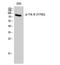 NTRK2 antibody, A01388Y706-1, Boster Biological Technology, Western Blot image 