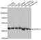 Ubiquinol-Cytochrome C Reductase Core Protein 2 antibody, A4181, ABclonal Technology, Western Blot image 