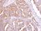 Pleckstrin Homology Domain Containing A5 antibody, GTX122690, GeneTex, Immunohistochemistry paraffin image 