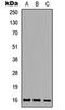 Ataxin 7 Like 1 antibody, orb235034, Biorbyt, Western Blot image 