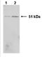 Heterogeneous Nuclear Ribonucleoprotein K antibody, AM05384PU-N, Origene, Western Blot image 