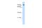 Solute Carrier Family 5 Member 11 antibody, A10043-1, Boster Biological Technology, Western Blot image 