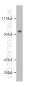 Sterile Alpha Motif Domain Containing 4B antibody, 17723-1-AP, Proteintech Group, Western Blot image 