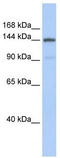 Collagen Type I Alpha 2 Chain antibody, TA344339, Origene, Western Blot image 