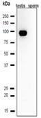 Calmegin antibody, GTX00744, GeneTex, Western Blot image 
