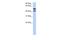 Glucosamine (N-Acetyl)-6-Sulfatase antibody, A00999, Boster Biological Technology, Western Blot image 