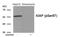 X-Linked Inhibitor Of Apoptosis antibody, GTX55394, GeneTex, Western Blot image 