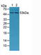 Matrix Metallopeptidase 13 antibody, LS-C298277, Lifespan Biosciences, Western Blot image 