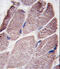 Protein Tyrosine Phosphatase Non-Receptor Type 21 antibody, 63-463, ProSci, Immunohistochemistry paraffin image 