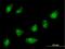 Zinc Finger Protein 576 antibody, H00079177-B01P, Novus Biologicals, Immunocytochemistry image 