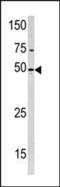 PXK protein antibody, PA5-13743, Invitrogen Antibodies, Western Blot image 