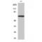 Protein Inhibitor Of Activated STAT 3 antibody, LS-C385482, Lifespan Biosciences, Western Blot image 