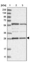Phosphatase, Orphan 2 antibody, PA5-57032, Invitrogen Antibodies, Western Blot image 