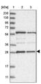 Phosphatase, Orphan 2 antibody, PA5-57032, Invitrogen Antibodies, Western Blot image 