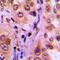 Serum/Glucocorticoid Regulated Kinase 1 antibody, LS-C358307, Lifespan Biosciences, Immunohistochemistry frozen image 