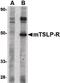 Cytokine receptor-like factor 2 antibody, LS-C34698, Lifespan Biosciences, Western Blot image 