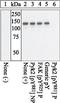 Protein Tyrosine Kinase 2 Beta antibody, GTX24801, GeneTex, Western Blot image 