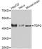 Tyrosyl-DNA Phosphodiesterase 2 antibody, abx126687, Abbexa, Western Blot image 