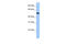 COP9 Signalosome Subunit 2 antibody, 25-187, ProSci, Enzyme Linked Immunosorbent Assay image 