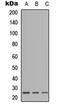 Immunoglobulin Lambda Like Polypeptide 1 antibody, orb256616, Biorbyt, Western Blot image 