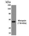 Serine Protease 27 antibody, NBP2-11786, Novus Biologicals, Western Blot image 