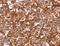 Heat Shock Protein Family B (Small) Member 6 antibody, LS-C403229, Lifespan Biosciences, Immunohistochemistry paraffin image 