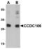 Coiled-Coil Domain Containing 106 antibody, LS-B5314, Lifespan Biosciences, Western Blot image 