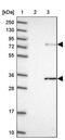 Zinc Finger Containing Ubiquitin Peptidase 1 antibody, PA5-60709, Invitrogen Antibodies, Western Blot image 