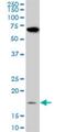 NADH:Ubiquinone Oxidoreductase Subunit B11 antibody, H00054539-M08, Novus Biologicals, Western Blot image 