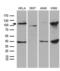 L3MBTL Histone Methyl-Lysine Binding Protein 3 antibody, LS-C800001, Lifespan Biosciences, Western Blot image 