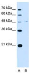 Olfactomedin 4 antibody, TA339890, Origene, Western Blot image 