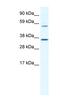 Mesoderm Posterior BHLH Transcription Factor 2 antibody, MBS834362, MyBioSource, Western Blot image 