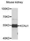 Potassium Voltage-Gated Channel Subfamily J Member 1 antibody, LS-B15590, Lifespan Biosciences, Western Blot image 