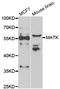 Megakaryocyte-Associated Tyrosine Kinase antibody, LS-C334850, Lifespan Biosciences, Western Blot image 