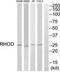 Ras Homolog Family Member D antibody, PA5-39423, Invitrogen Antibodies, Western Blot image 