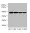 Procollagen C-Endopeptidase Enhancer 2 antibody, CSB-PA017632LA01HU, Cusabio, Western Blot image 