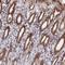 DnaJ Heat Shock Protein Family (Hsp40) Member C17 antibody, NBP1-84614, Novus Biologicals, Immunohistochemistry paraffin image 